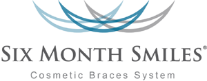 Six Month Smiles Cosmetic Braces Fairfax